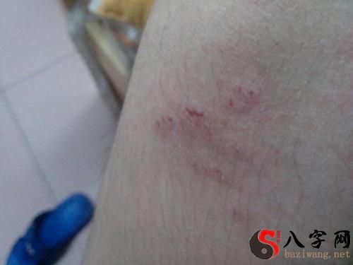 梦见被老鼠咬到手