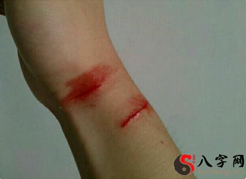 梦见手背流血